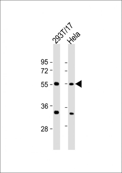 AAAS Antibody (C-Term)