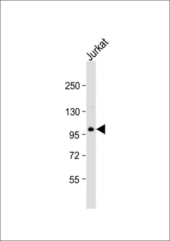 TSC22D1 Antibody (C-Term)