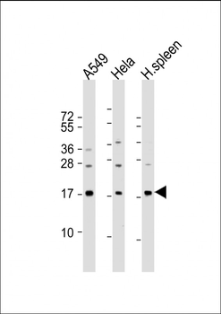 PLA2G2A Antibody (C-Term)