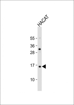TCTA Antibody (N-Term)