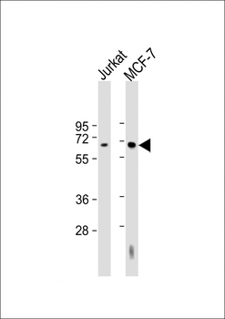 HEXB Antibody (Center)