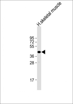 TMEM115 Antibody (C-Term)