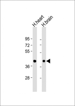 BRCC3 Antibody (N-Term)
