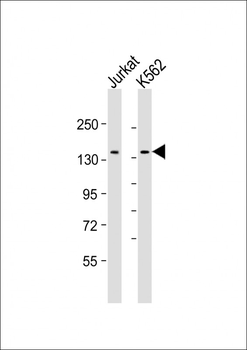 TACC3 Antibody (Center)