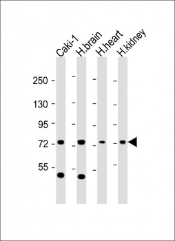 RNF139 Antibody (C-Term)
