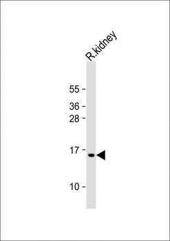 ATP5G3 Antibody (N-Term)