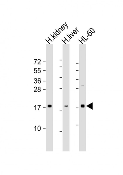 FHIT Antibody (N-Term)