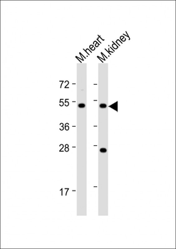 PIGU Antibody (N-Term)