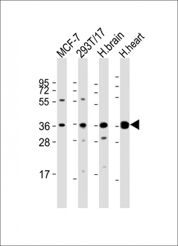 BRCC3 Antibody (N-Term)