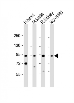 PDE1C Antibody (Center)