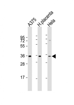 FGF5 Antibody (N-Term)