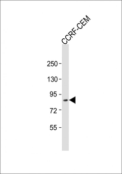 ZKSCAN5 Antibody (N-Term)