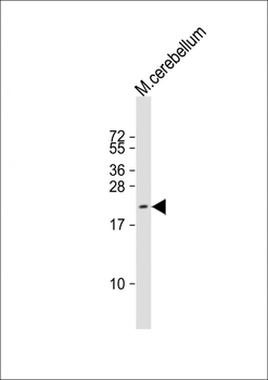 RAP2A Antibody (N-Term)