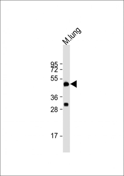 DPEP2 Antibody (Center)