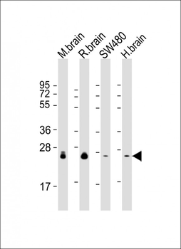 RAB3B Antibody