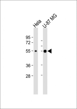 NXF3 Antibody (N-Term)