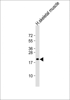 NACA2 Antibody (N-Term)