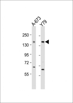 CACNA1F Antibody (Center)