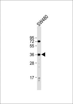 PRSS23 Antibody (Center)