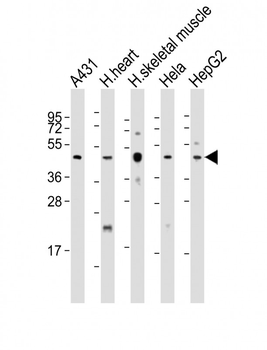 TFDP2 Antibody (Center)