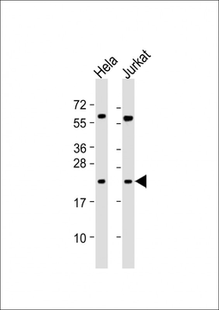 PSMB6 Antibody (Center)