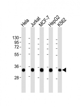 HNRNPA1L2 Antibody (N-Term)