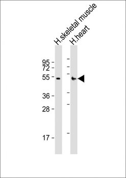 RHBDL1 Antibody (Center)