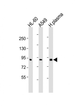 F2 Antibody (N-Term)