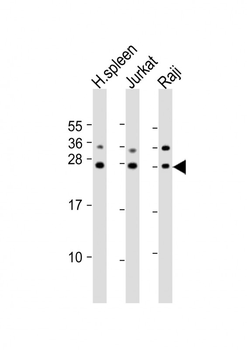 GZMH Antibody (N-Term)