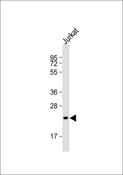 FGF6 Antibody (Center)