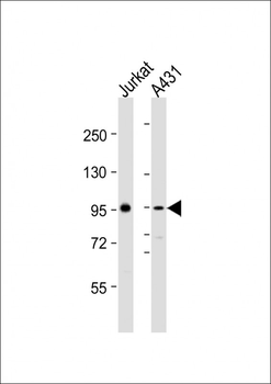 NCSTN Antibody (N-Term)