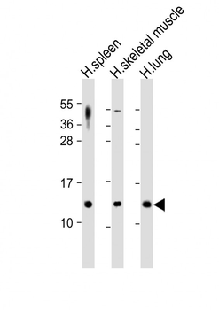 CCL17 Antibody