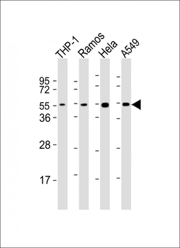 MAP2K7 Antibody (C-Term)