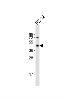 MAP2K7 Antibody (C-Term)
