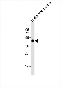 AGPHD1 Antibody (N-Term)
