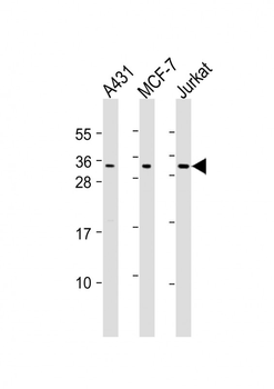 CASP14 Antibody (N-Term)