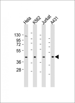 RBMX Antibody (Center)