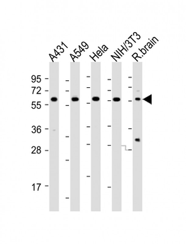 PICALM Antibody (Center)