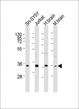 RASSF2 Antibody (Center)