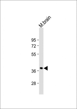 RASSF2 Antibody (N-Term)