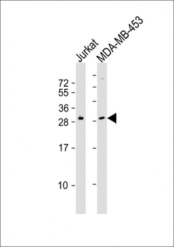 SSX2 Antibody (Center)