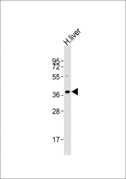 LMX1A Antibody (C-term)