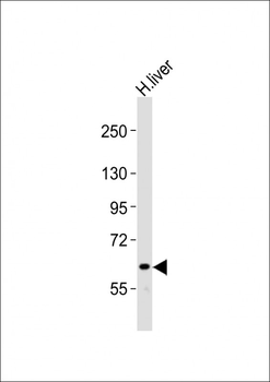NOTCH4 Antibody (C-term)