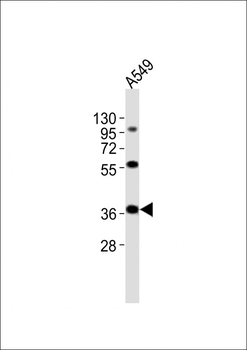 CTSL Antibody (N-Term)