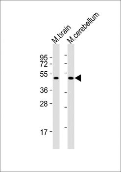 PORCN Antibody (Center)