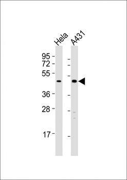 LEFTY2 Antibody