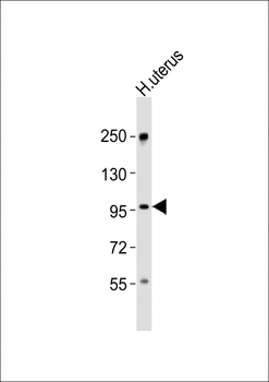 CHSY3 Antibody (C-term)