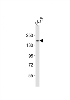 ITGA3 Antibody (C-term)