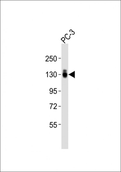 ITGA3 Antibody (N-term)