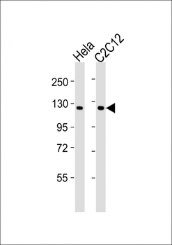 PTK7 Antibody (N-Term)